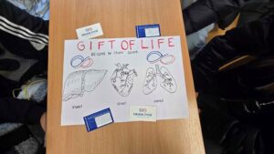 Transplantacja na językach (14)